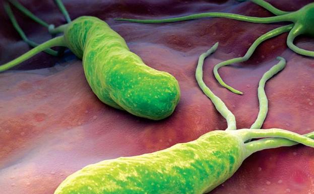 Remedios caseros para la bacteria helicobacter pylori